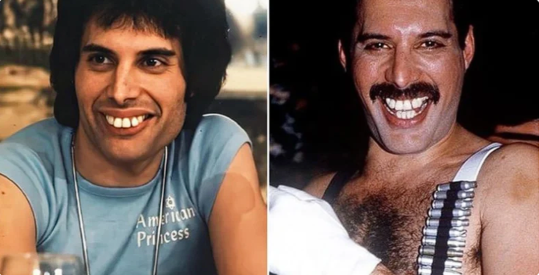 Freddie Mercury teeth